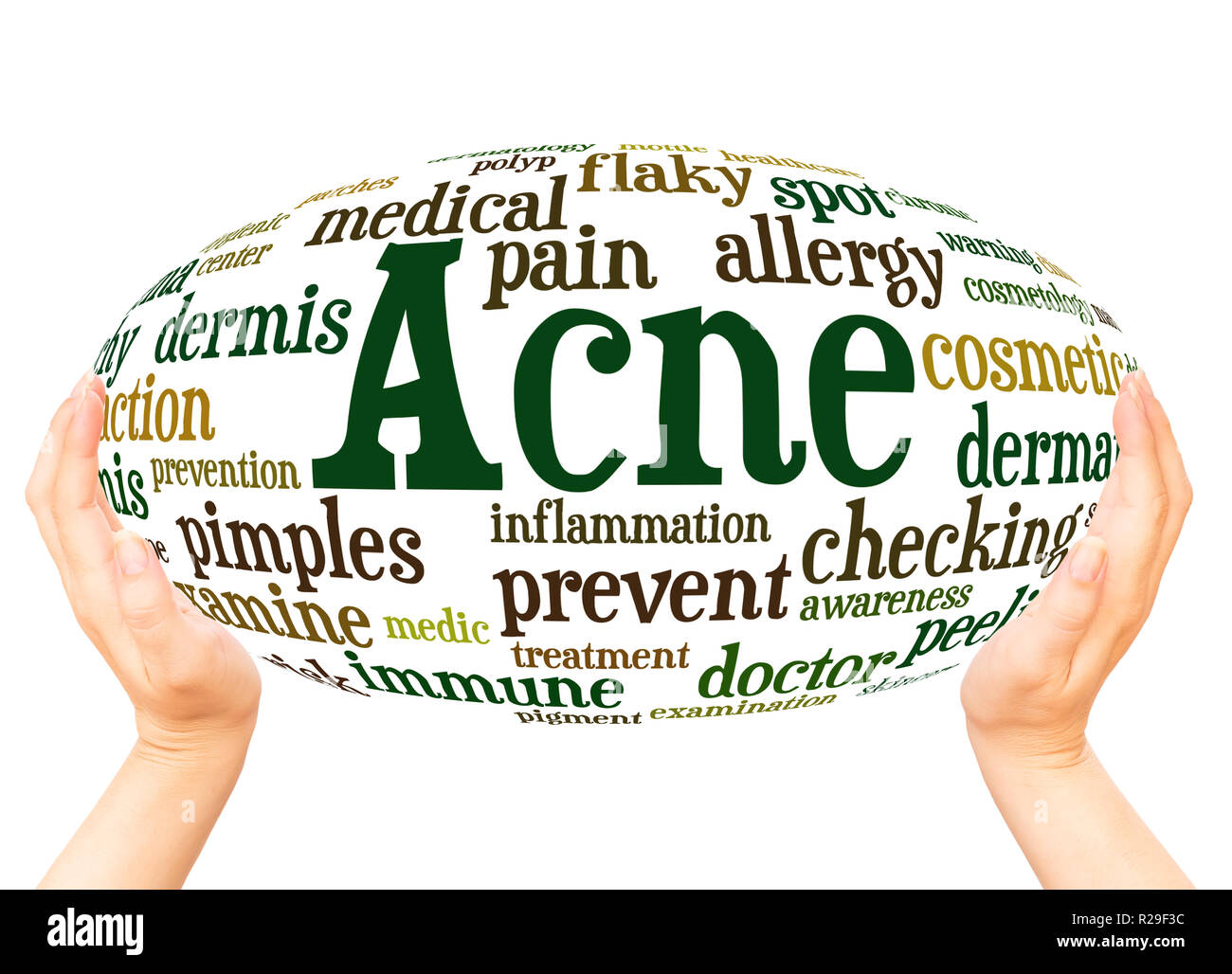 Acne word cloud hand sphere concept on white background. Stock Photo