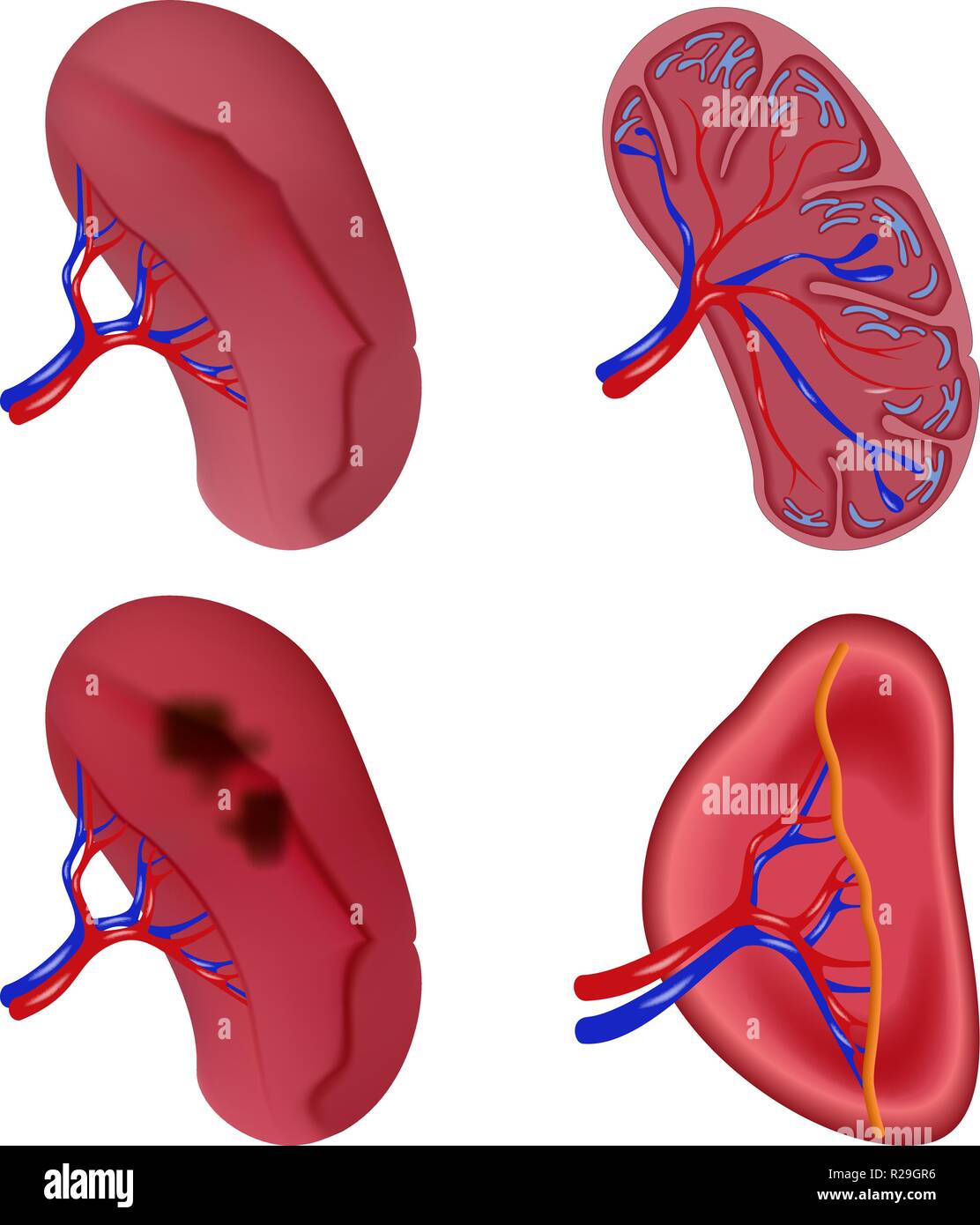 Spleen milt anatomy icons set. Realidtic illustration of 4 spleen milt