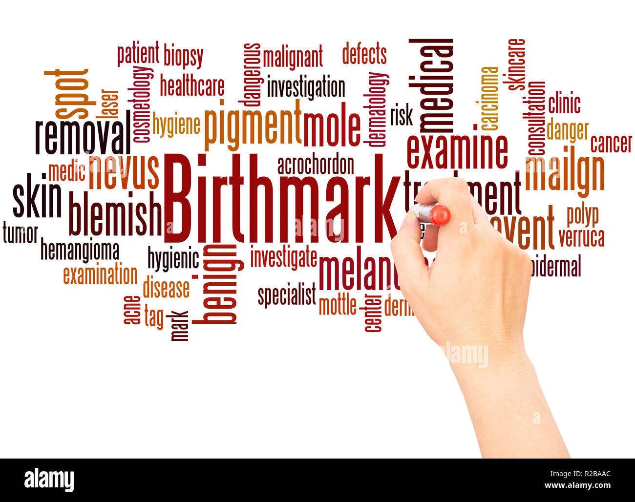 Birthmark word cloud hand writing concept on white background Stock ...