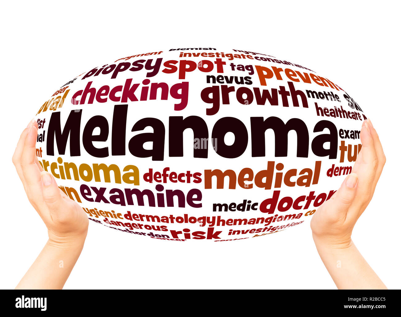 Melanoma word cloud concept on white background Stock Photo Alamy