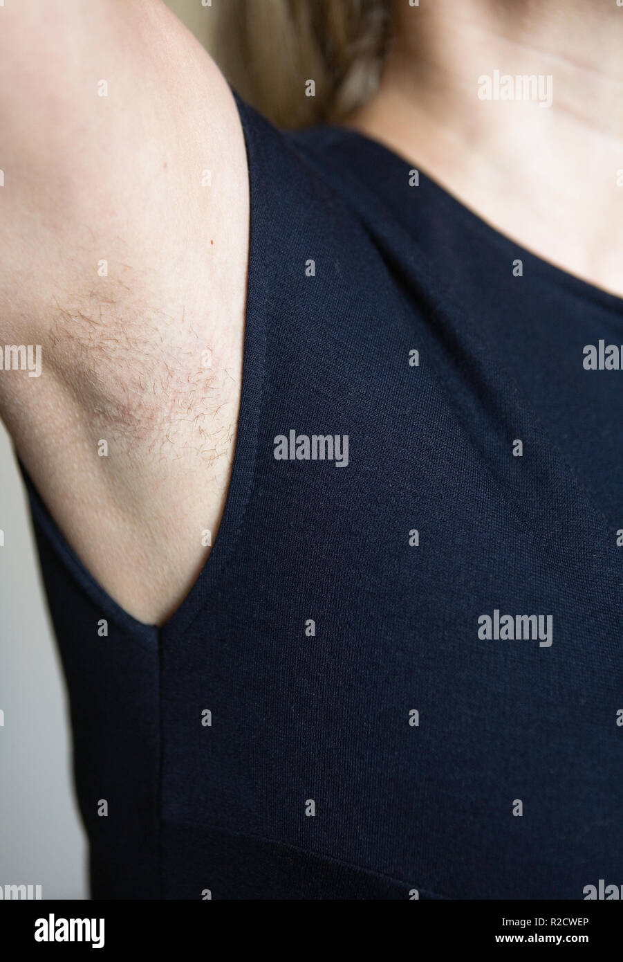 Unshaven hairy female armpit closeup. Body care. Stock Photo