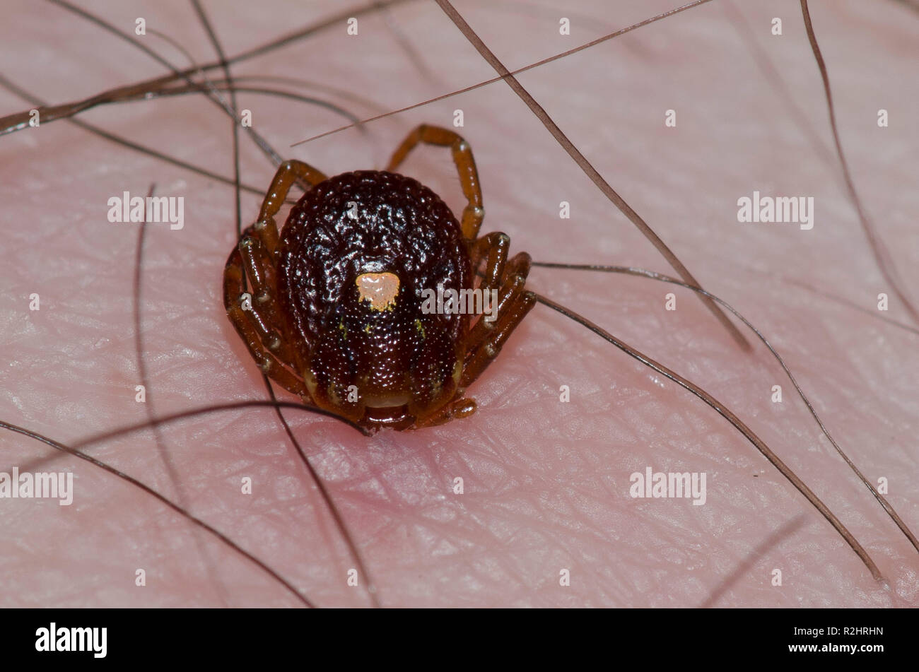 Lone Star Tick, Amblyomma americanum, female attached to human skin Stock Photo