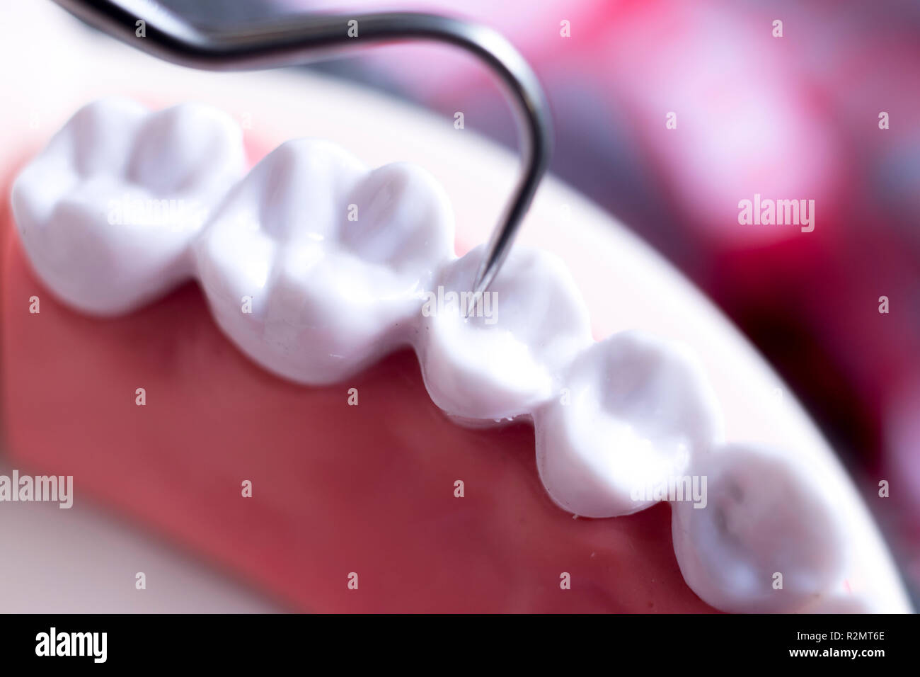 Dentist cleaning teeth with titanium metal tooth pick instrument to