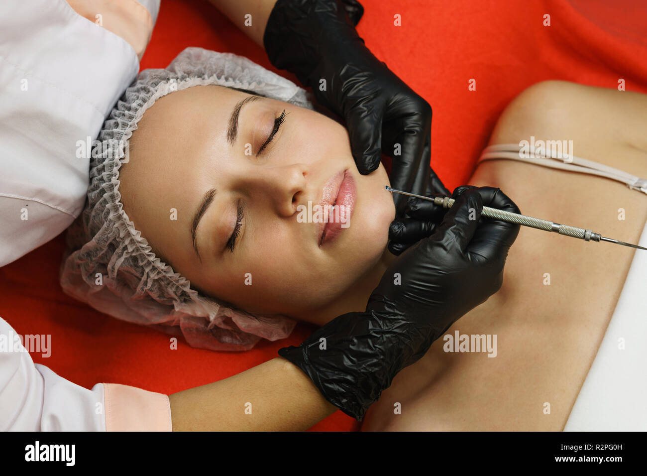 Hardware cosmetology. Beautician conducts spot cleaning of face of young woman. Removal of acne and cleansing of skin pores. Anti-aging treatments. Stock Photo