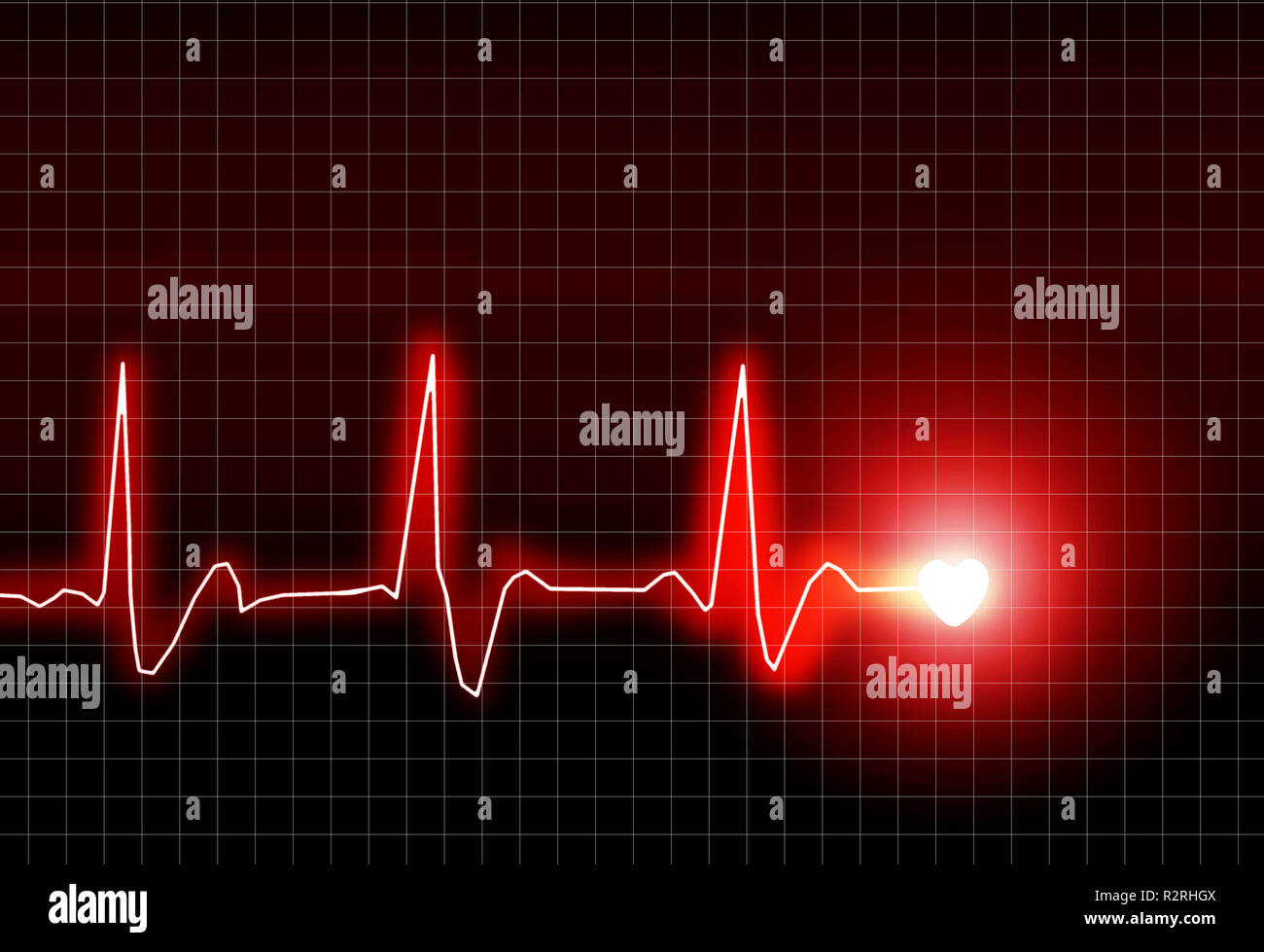 Ecg stress test hi-res stock photography and images - Alamy