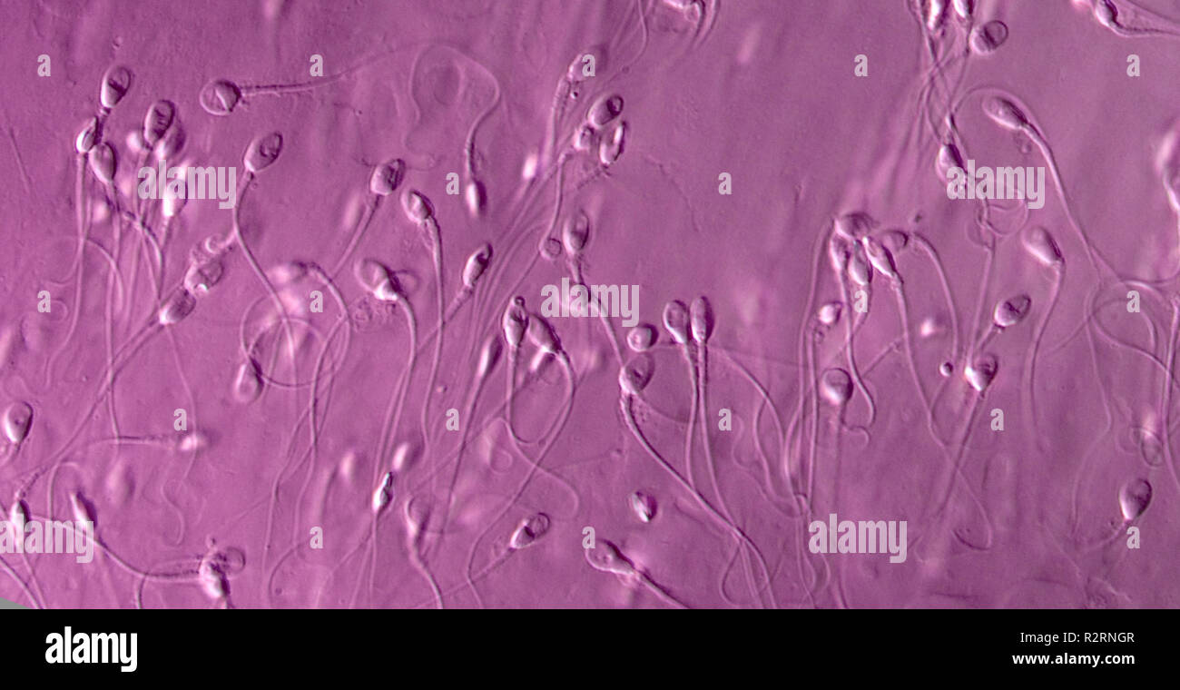 Gey pissing porno Tugilishdan oldin homilador ayollar bilan jinsiy aloqa video