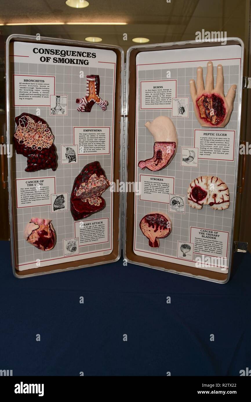tobacco radiation Members of NMCP's Radiation Oncology Warriors of Hope Committee set up a  display for Lung Cancer Awareness Month, in conjunction with the Great  American Smokeout Health Fair (GASO). GASO is an