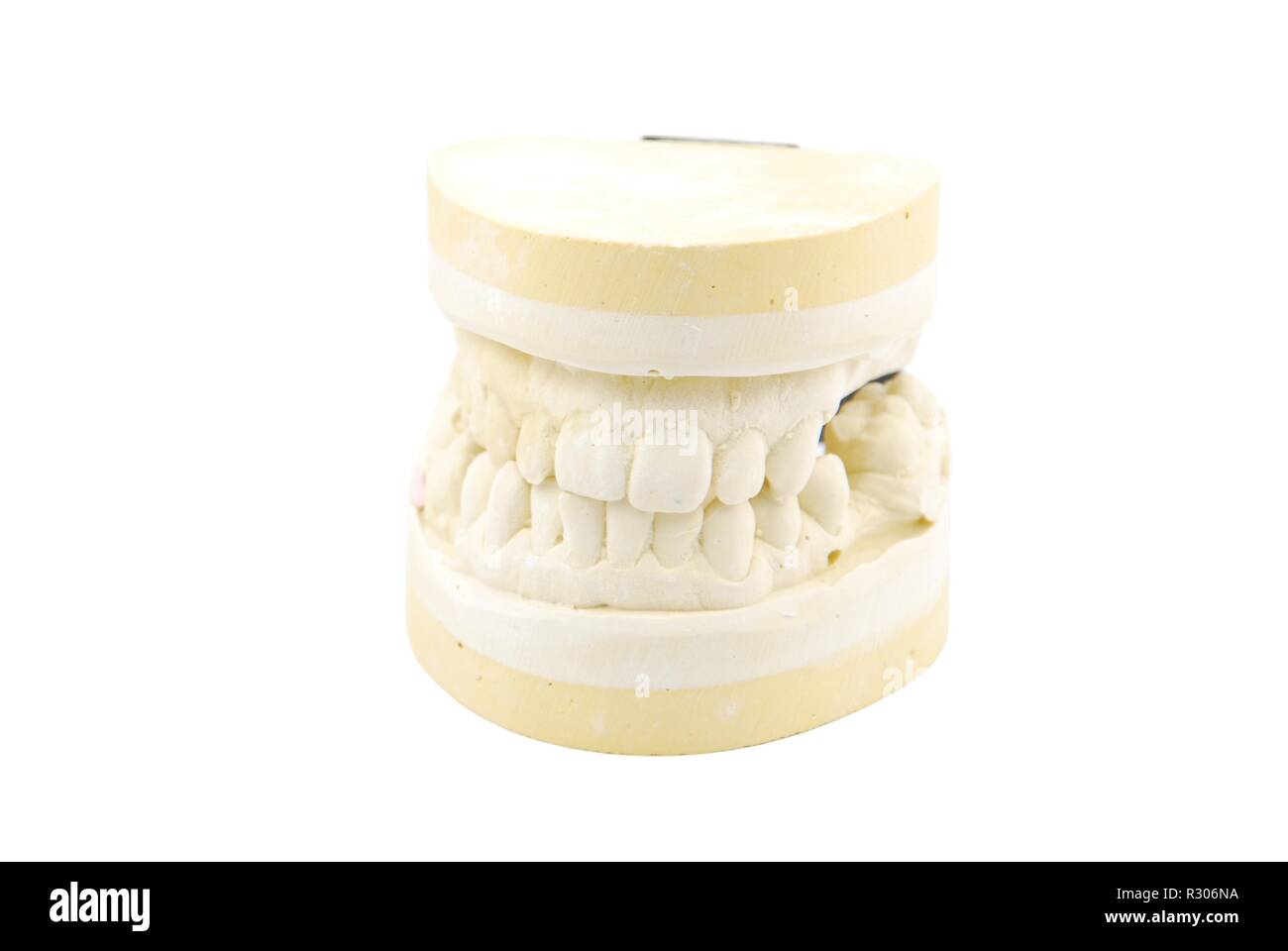 Dental chalk model hires stock photography and images Alamy