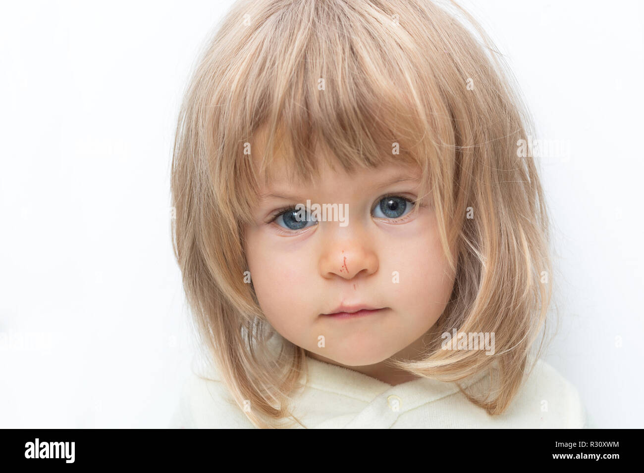 Blue-eyed blond baby with Bob hair and scratched nose close-up. Isolated on white. Female child looking seriously at camera in white studio, frowning eyebrows. Negative emotions, displeasure, offence. Stock Photo