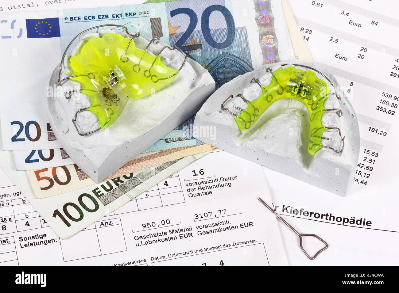 cost plan braces,orthodontics Stock Photo Alamy