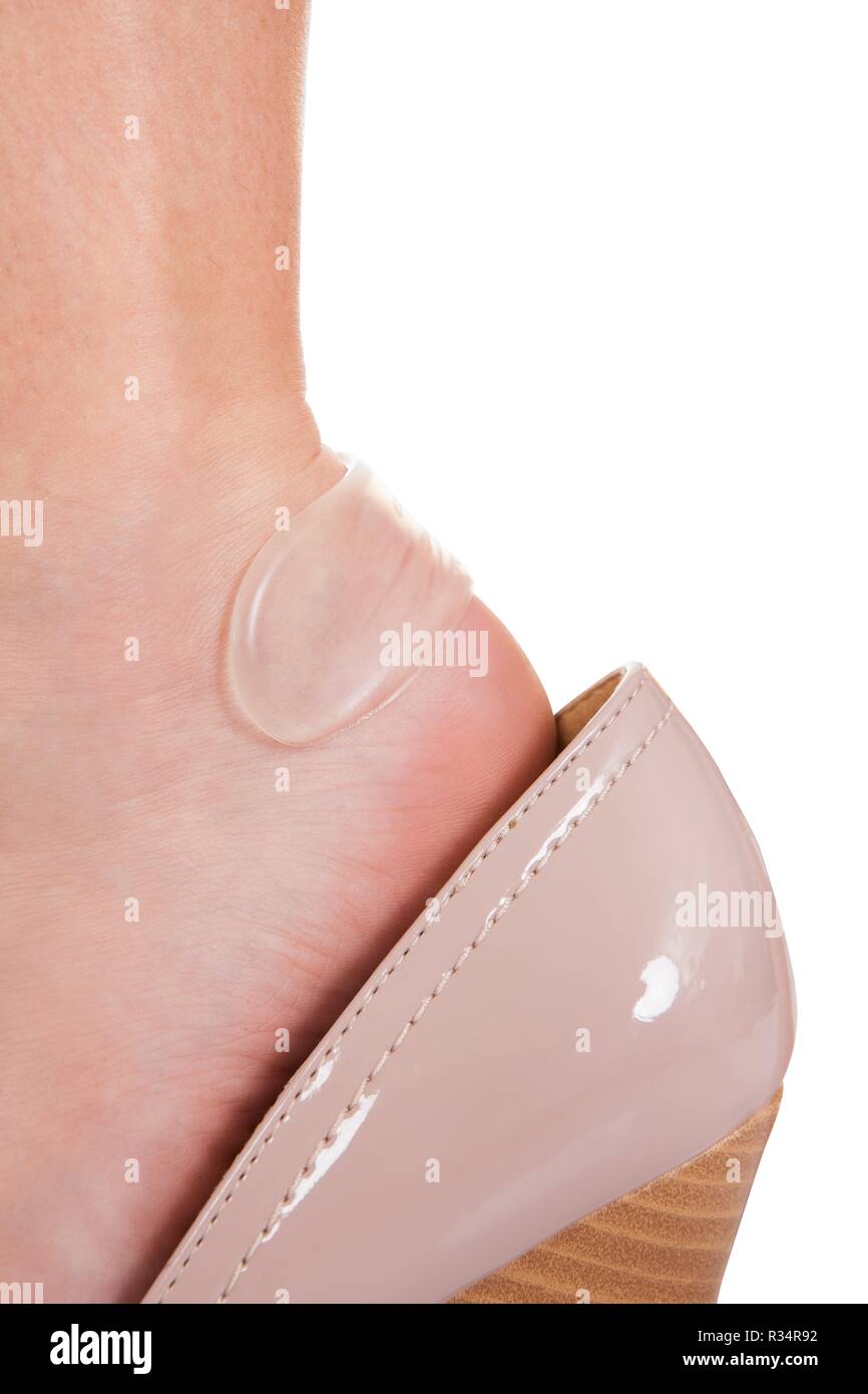 Blister Heel Stock Photos & Blister Heel Stock Images Alamy