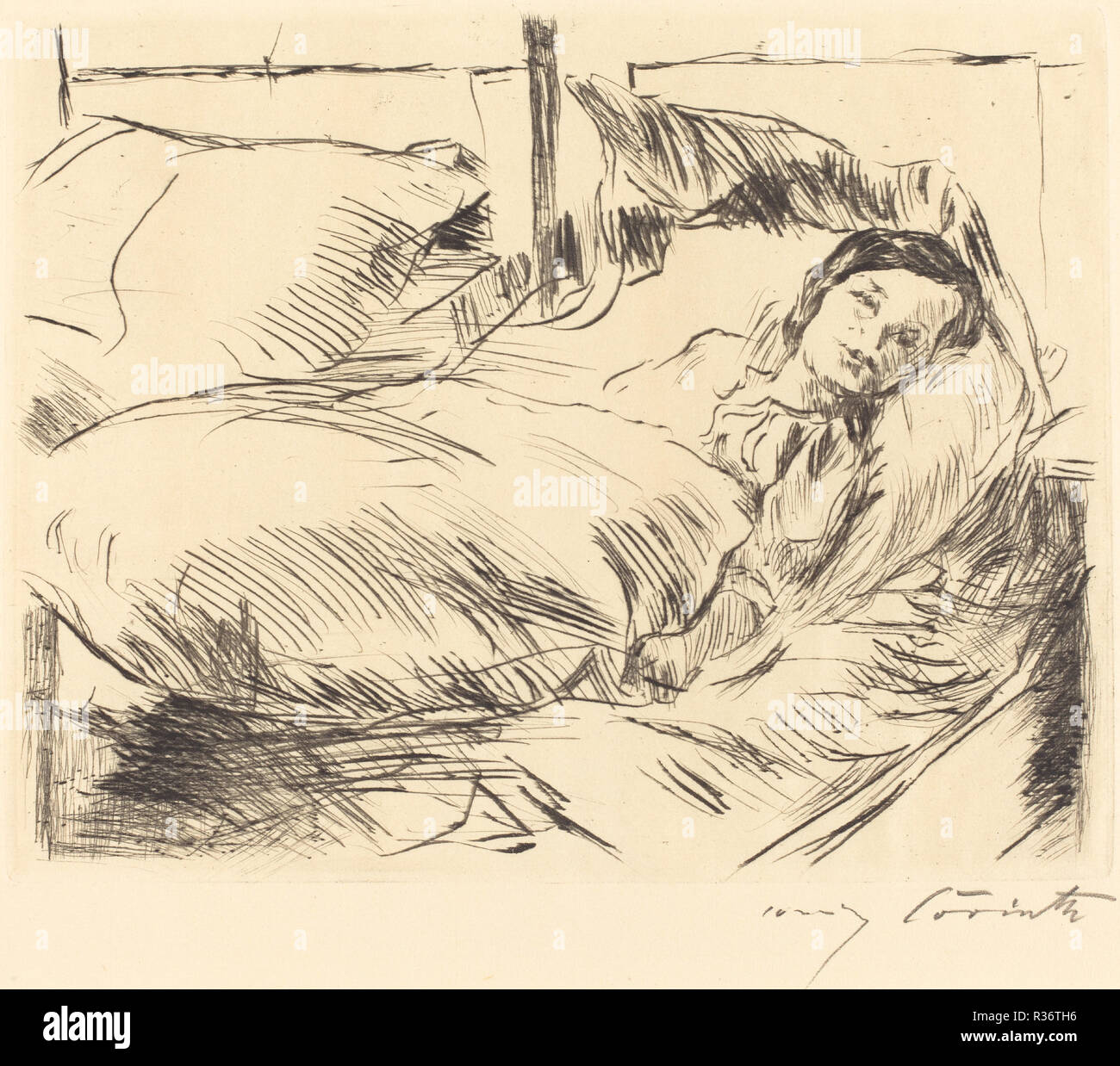 The Sick Child (Das Kranke Kind). Dated: 1918. Dimensions: plate: 19 x 24.1 cm (7 1/2 x 9 1/2 in.)  sheet: 28.4 x 30.3 cm (11 3/16 x 11 15/16 in.). Medium: drypoint in black on laid paper. Museum: National Gallery of Art, Washington DC. Author: Lovis Corinth. Stock Photo