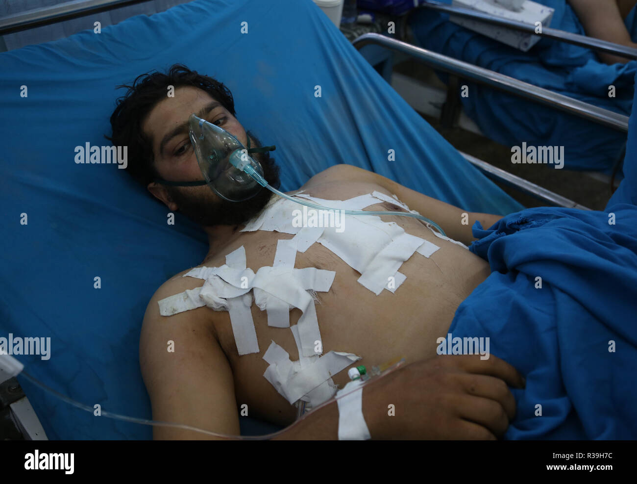 Kabul, Afghanistan. 22nd Nov, 2018. An injured man receives medical treatment at Wazir Akbar Khan hospital in Kabul, Afghanistan, Nov. 22, 2018. On Tuesday evening, a suicide bomber detonated his explosive belt at a wedding hall where scores of religious scholars and ordinary people were celebrating the birthday of Muslims Prophet Mohammad, killing over 60 and injuring more than 90 others, according to latest figures by the country's Ministry of Public Health. Credit: Rahmat Alizadah/Xinhua/Alamy Live News Stock Photo