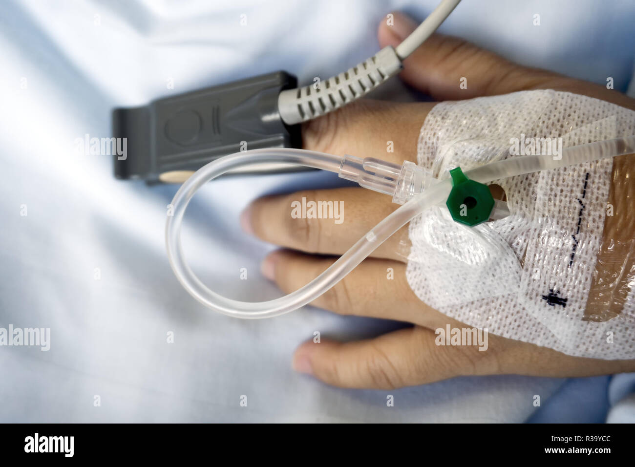 Close Up of SpO2 Sensor (peripheral capillary oxygen saturation) and Iv Drip on Patient's Hand at the Hospital Room. Stock Photo