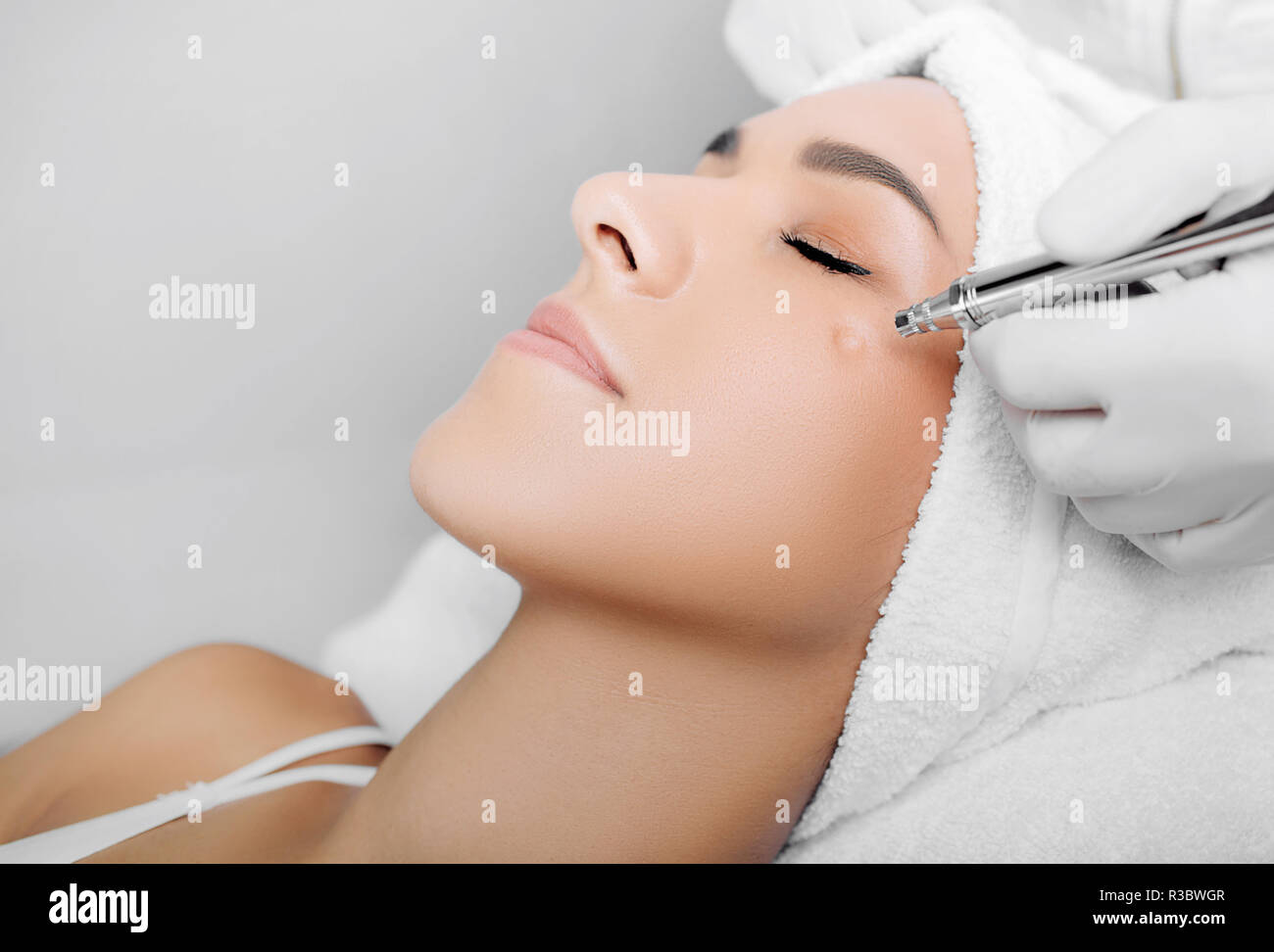 anti-aging face peel, procedure renewing skin , jet peeling Stock Photo