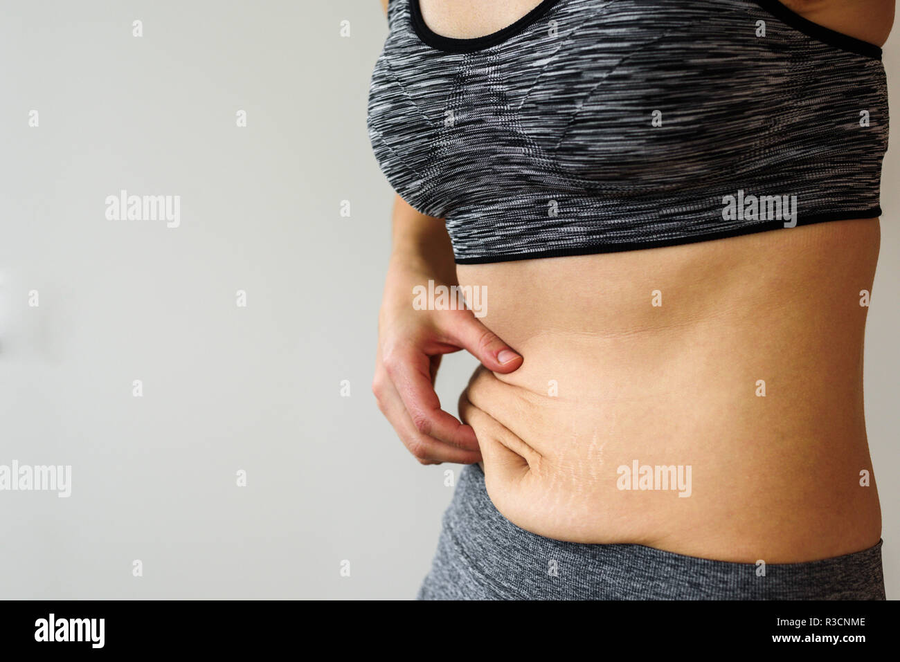 Woman belly after dieting. Skinny fat concept. Stretch marks Stock Photo