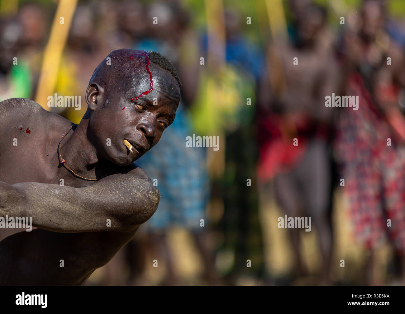 Suri tribe warrior bleeding during a donga stick fighting ritual, Omo valley, Kibish, Ethiopia Stock Photo