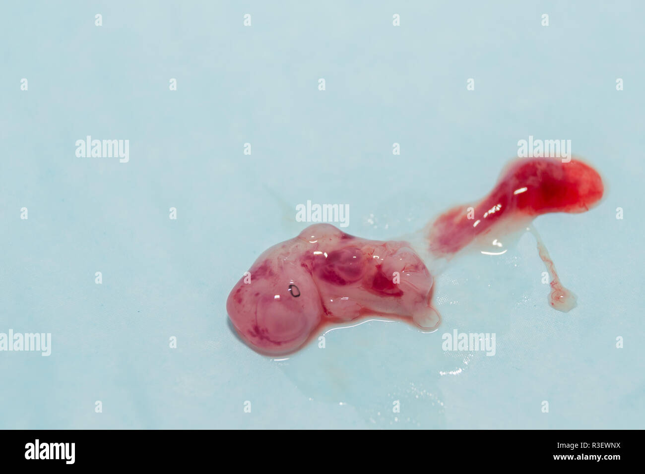 Small foetus outside from uterus on white background Stock Photo