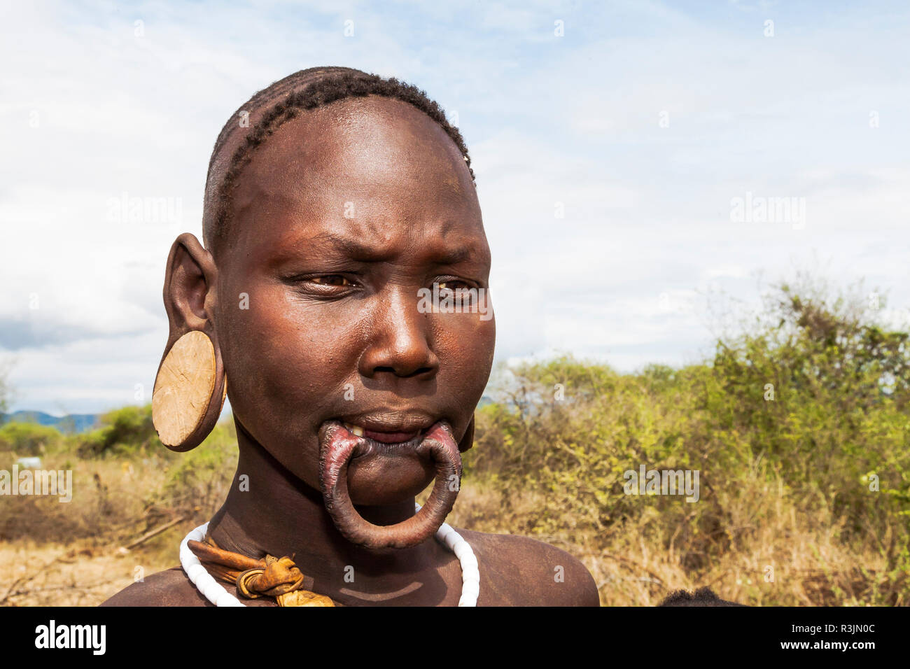 Africa, Ethiopia, Southern Omo Valley, Mursi Tribe. Mursi woman without her lip  plate inserted showing the stretched lower lip Stock Photo - Alamy