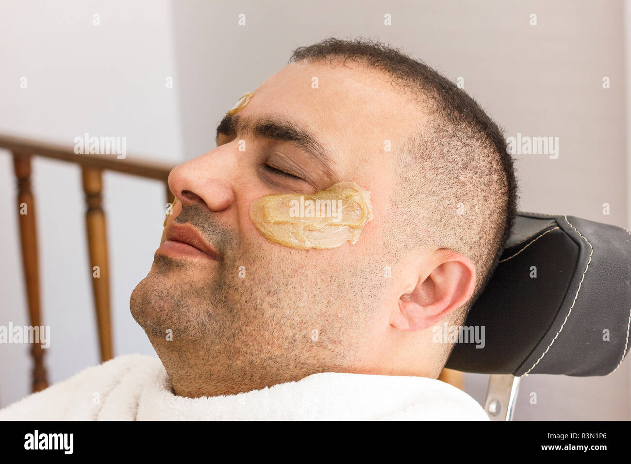 Hair Removal Man S Face Sugaring Epilations In Turkey Stock Photo