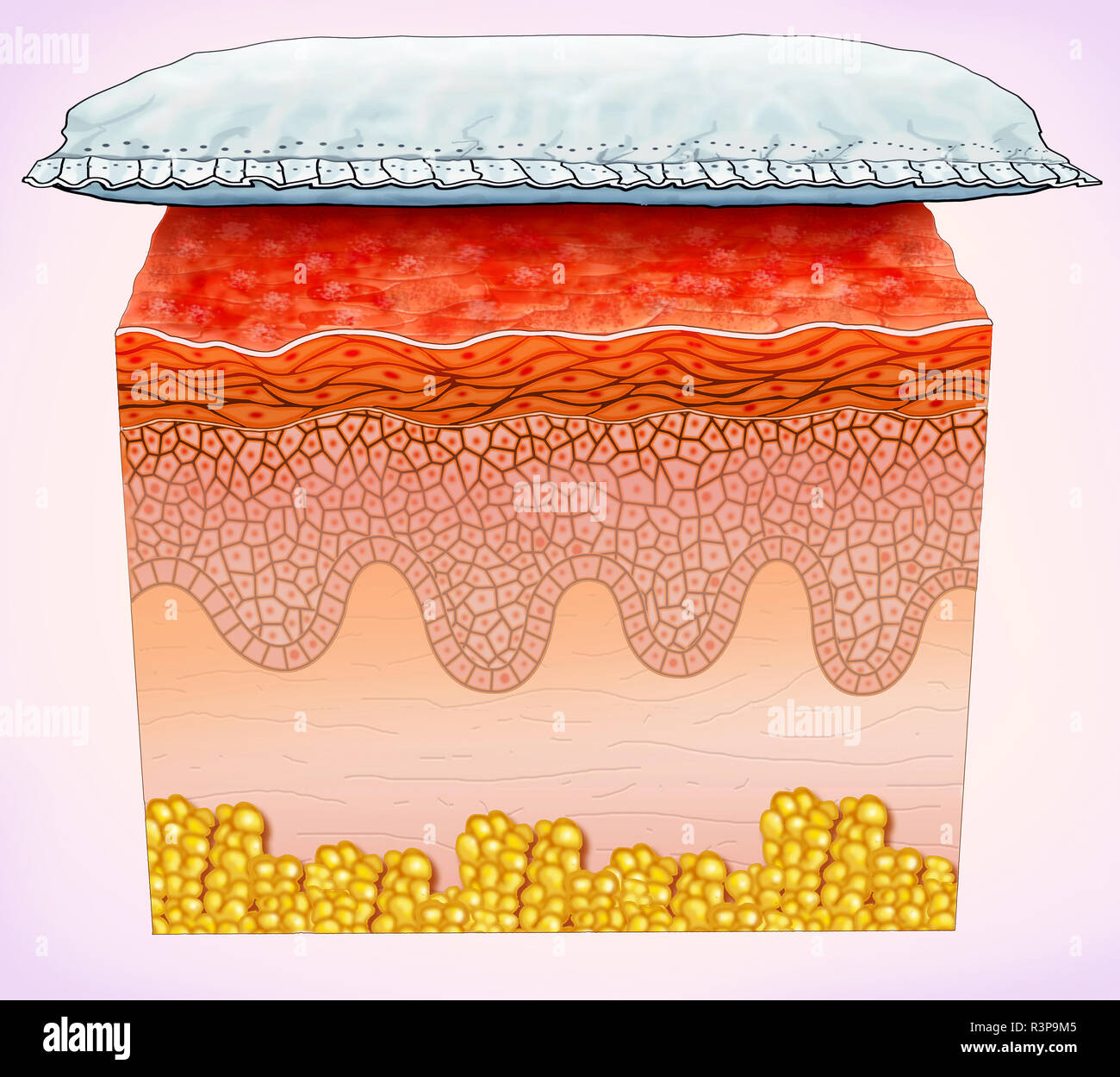 Diaper rash is an inflammation of the skin on the baby's bottom. It is