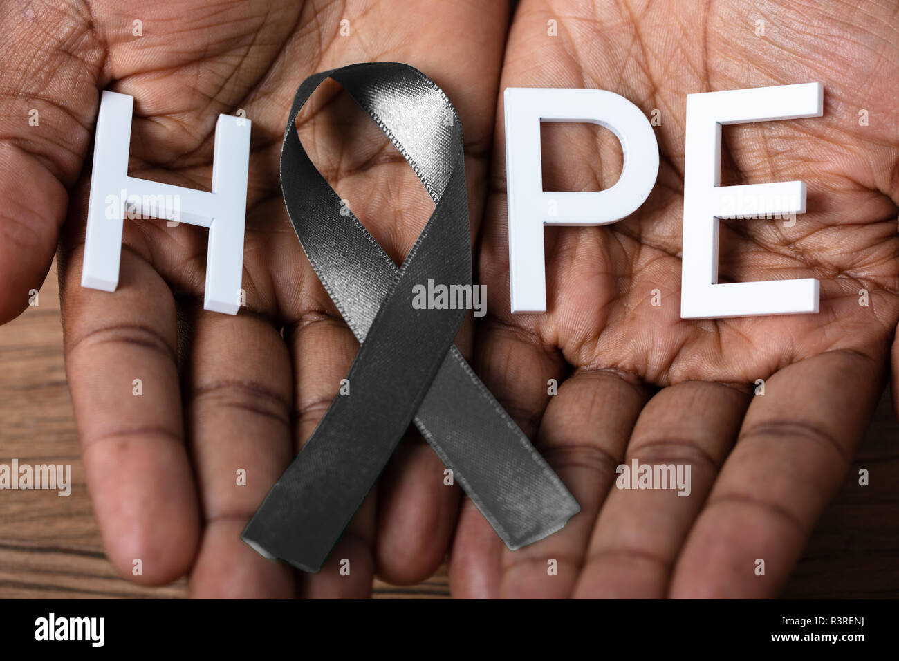 Person's Hand Holding Ribbon With Hope Text To Support Melanoma Skin Cancer Awareness Stock Photo