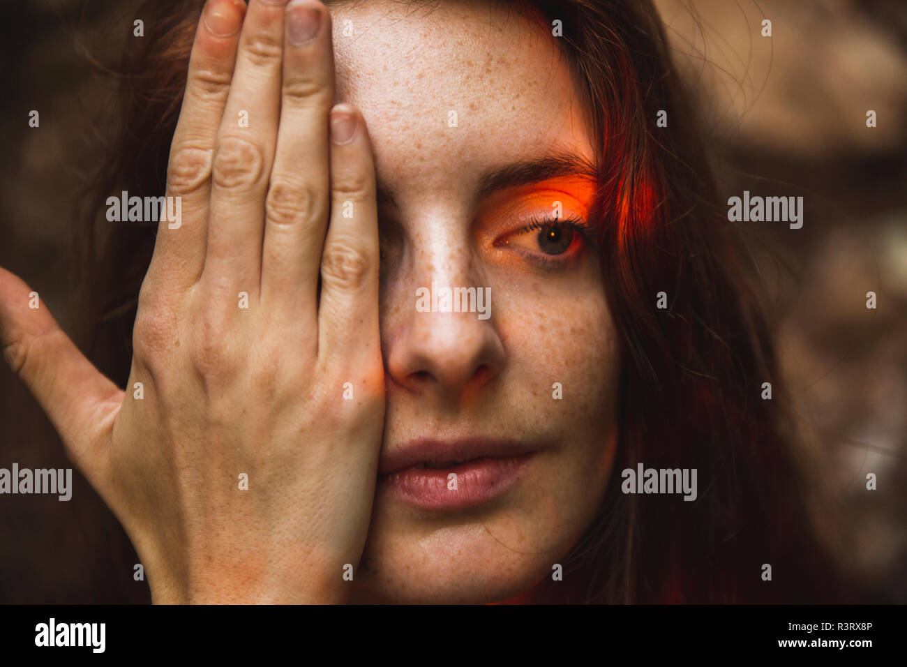 Portrait of young woman with freckles covering one eye Stock Photo