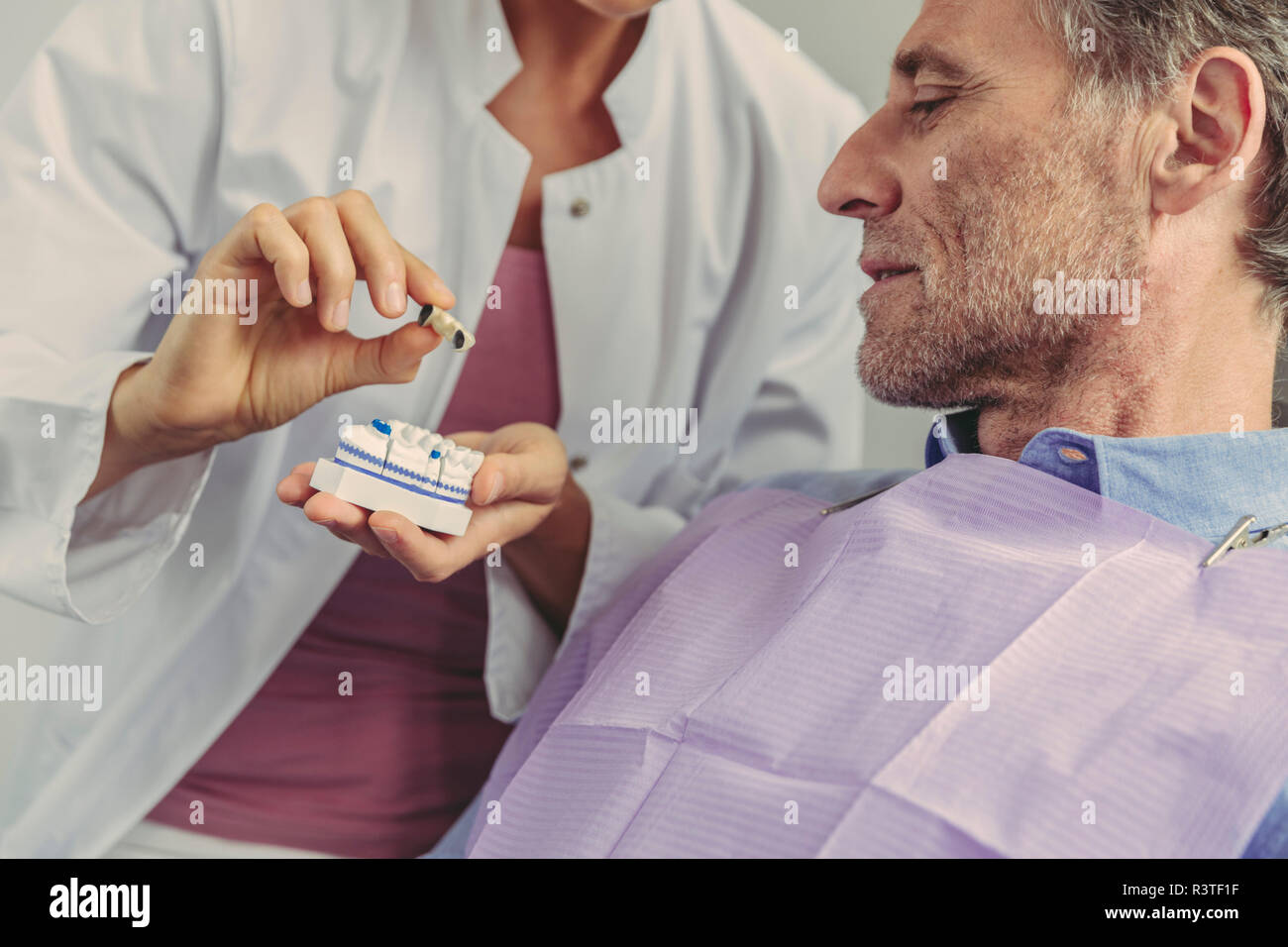 Dentist explaining dental bridge on a tooth model to patient Stock Photo