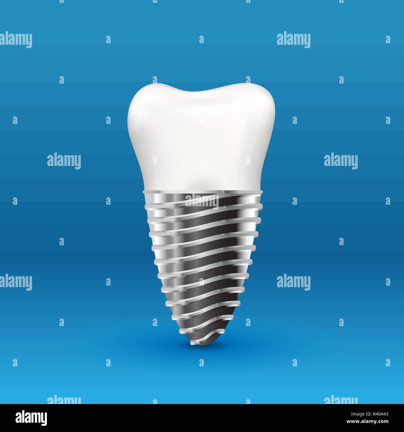 Realistic glossy human tooth implant with metallic screw Stock Vector