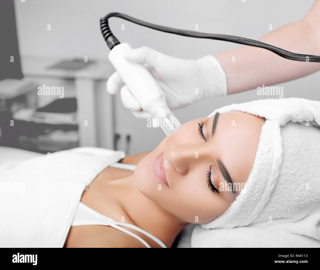 procedure renewing skin , no-needle high frequency mesotherapy Stock Photo