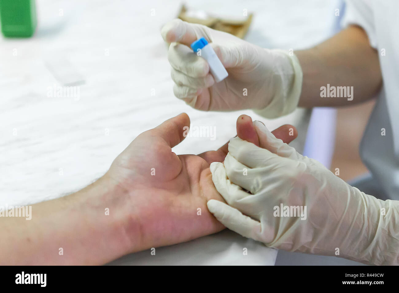 Finger blood test in the laboratory. The doctor pierces a finger. Close ...