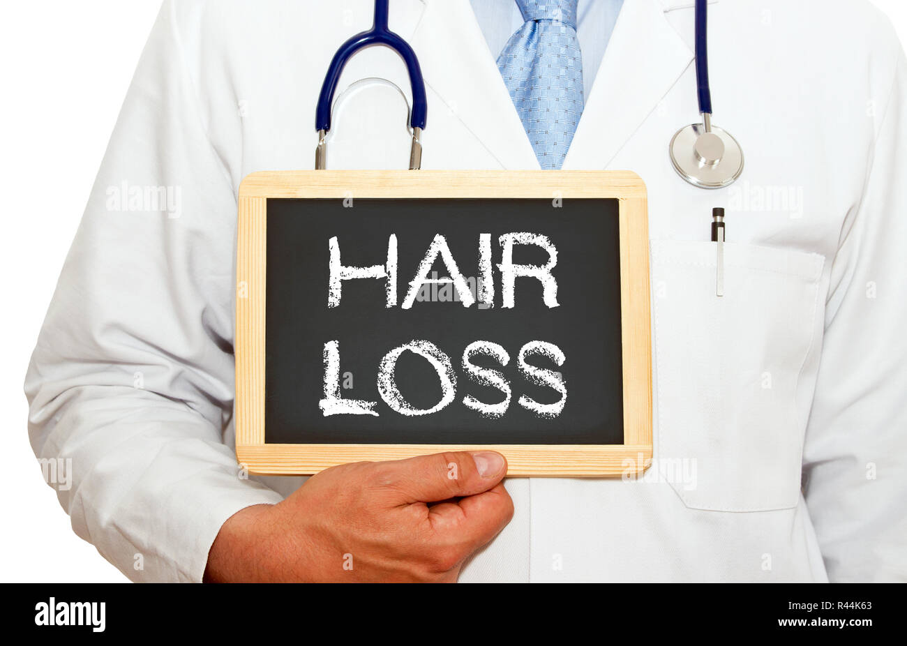 Hair Loss Doctor with chalkboard Stock Photo Alamy