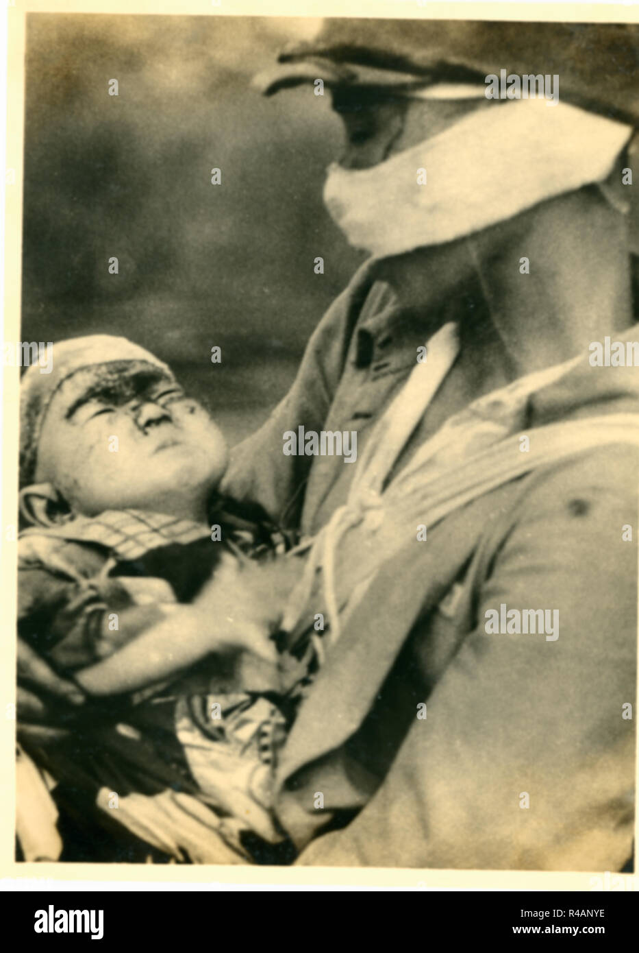 Wounded baby Hibakusha survivors victims of atomic bombing  Hiroshima, Japan, 1945 Stock Photo