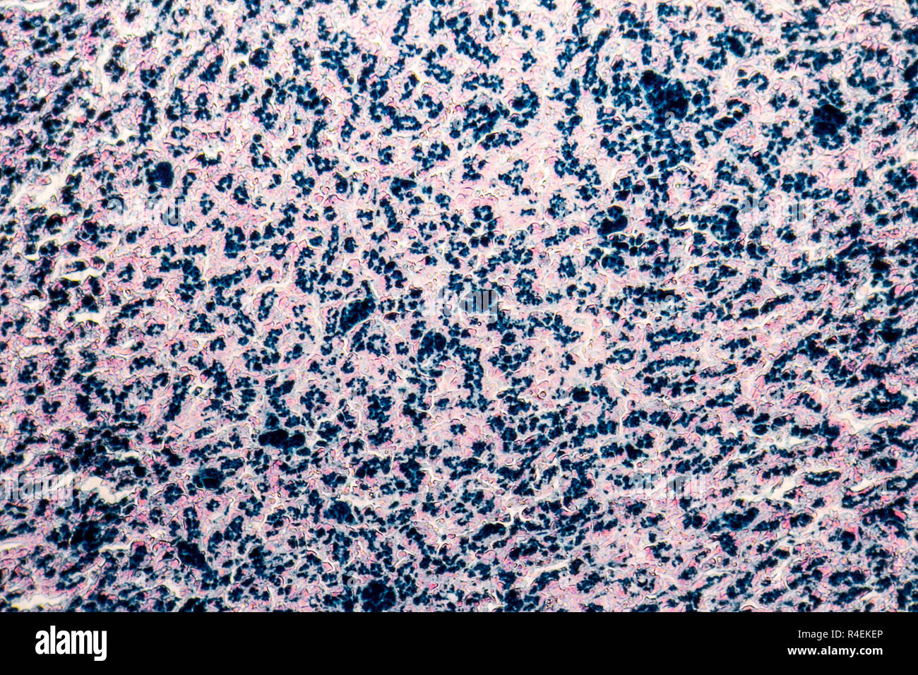 human liver micrography Stock Photo