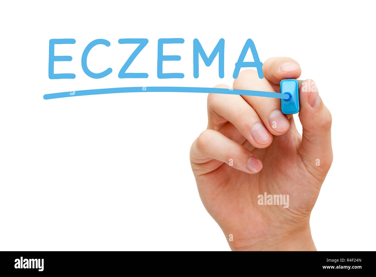 Eczema Handwritten With Blue Marker Stock Photo