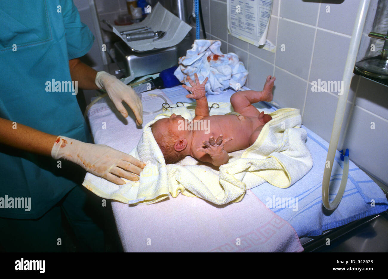 baby after birth in hospital Stock Photo Alamy