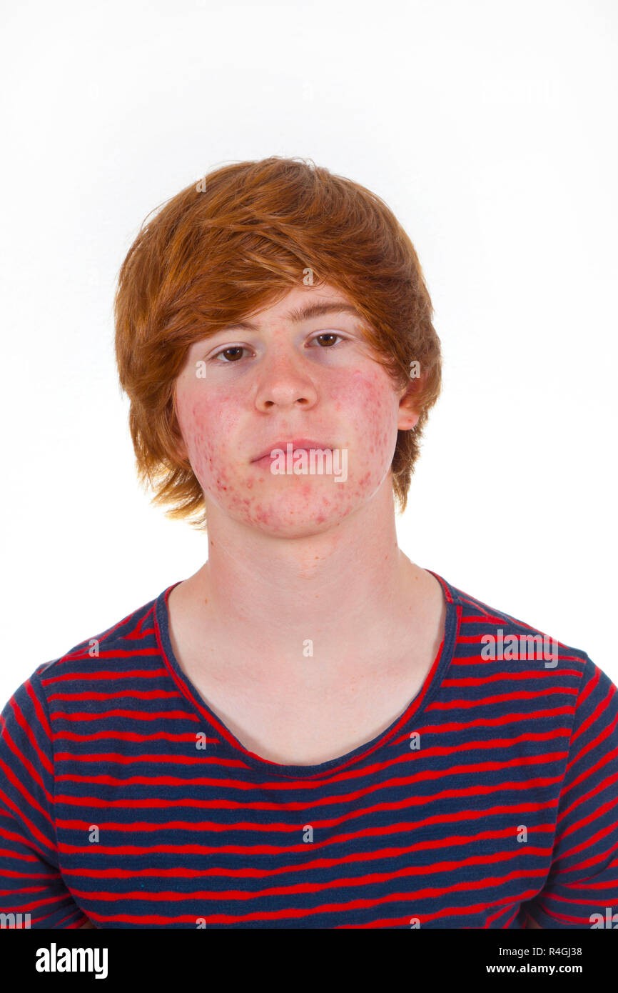 attractive boy in puberty with red hair Stock Photo - Alamy
