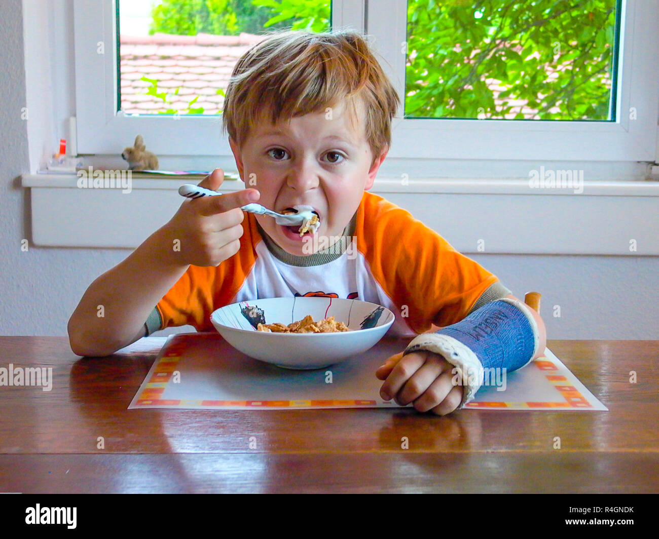 young boy with arm in cast has breakfast at the table Stock Photo