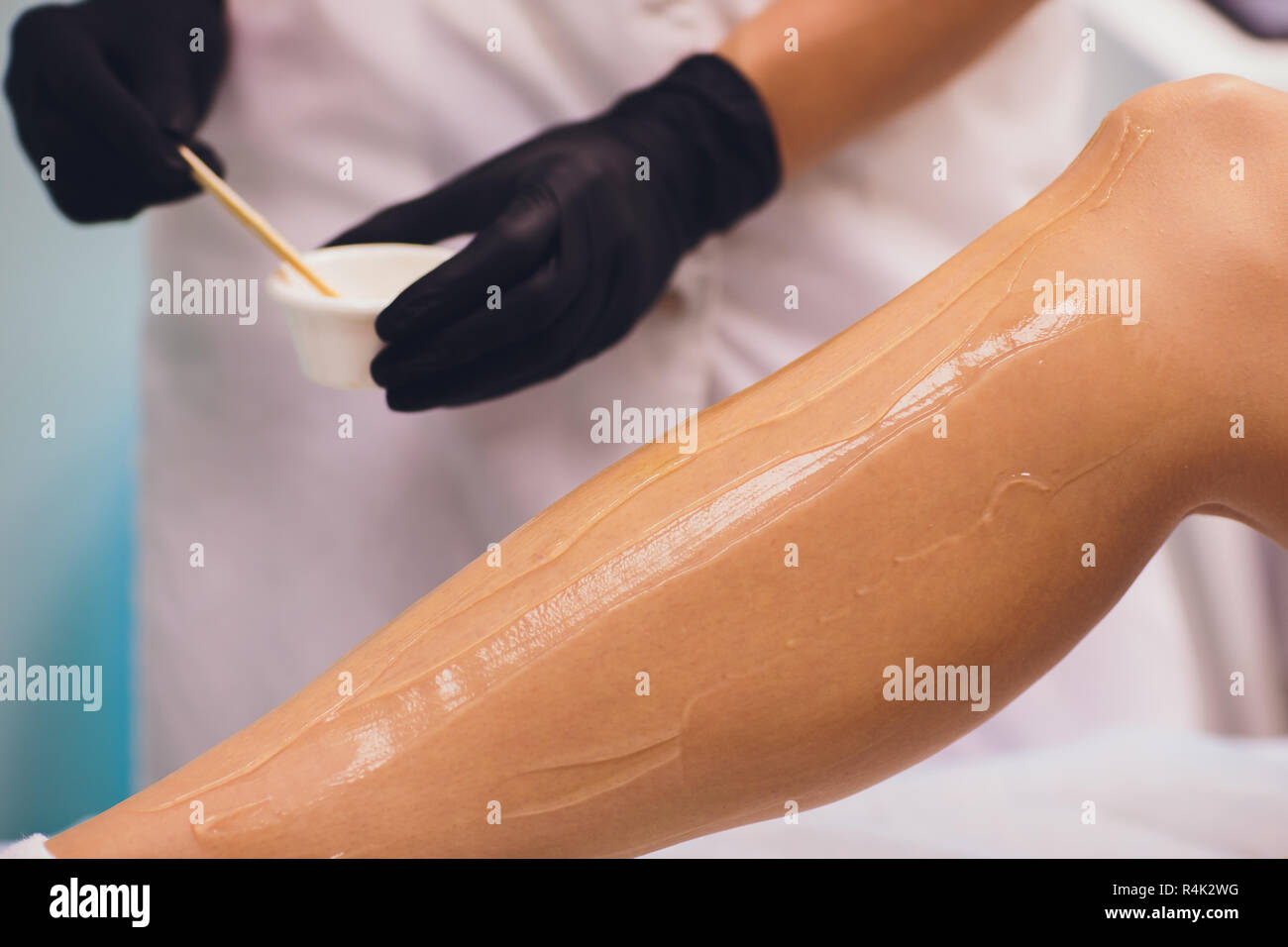 Beauty Depilation Epilation Hair Removal And People Concept