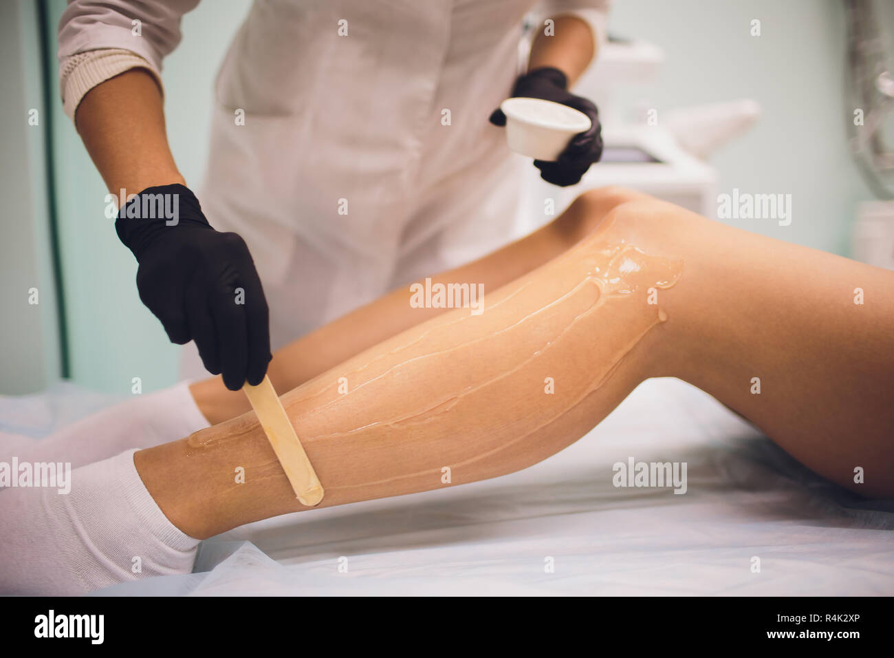 beauty, depilation, epilation, hair removal and people concept