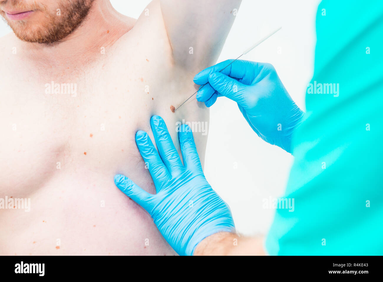 Doctor checking cancer patient hires stock photography and images Alamy