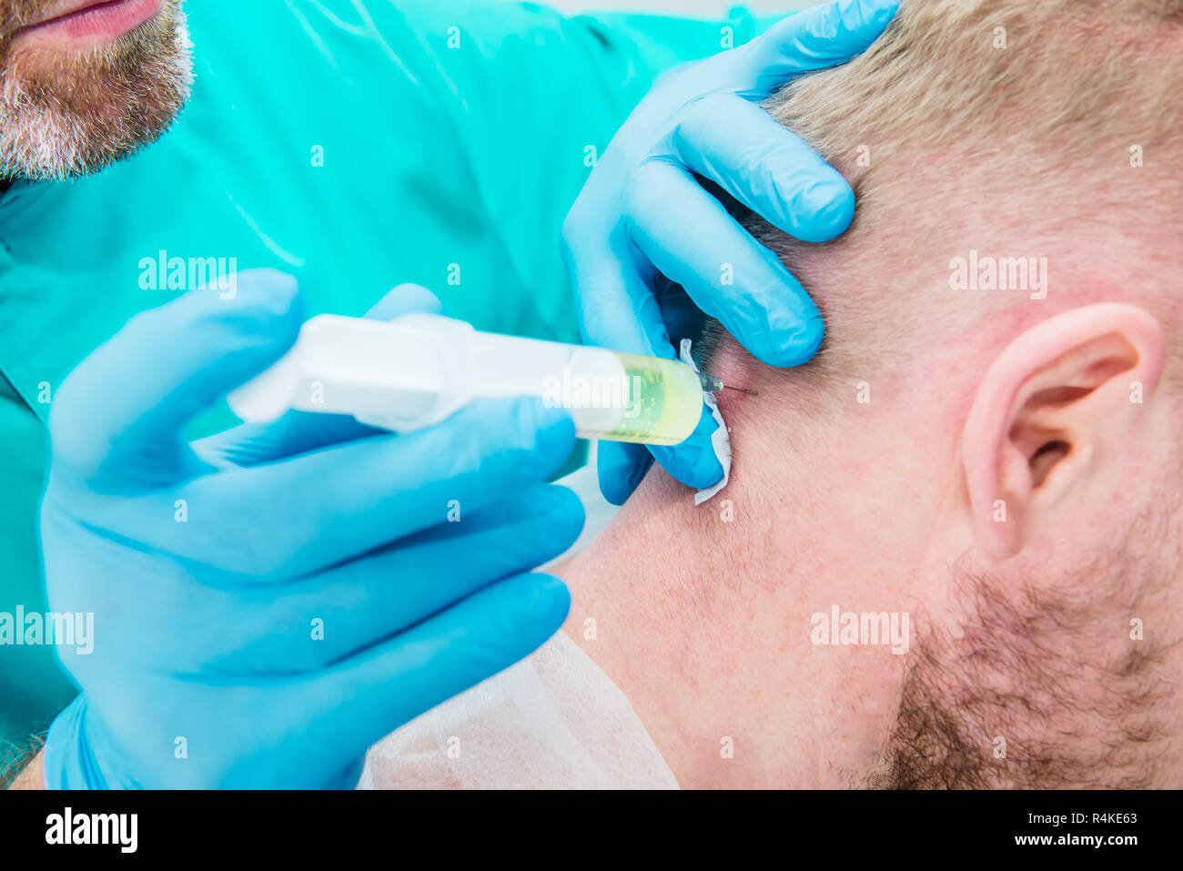 Close up Neurologist doctor makes an injection therapy (blockade) into head nape muscle of male patient. Alternative pain treatment concept. Selective Stock Photo