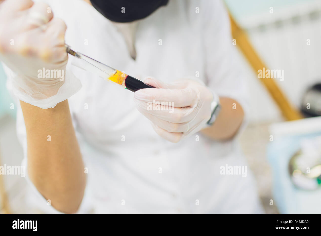 Set of preparation of blood plasma from the test tube in a syringe of blood plasma. Stock Photo