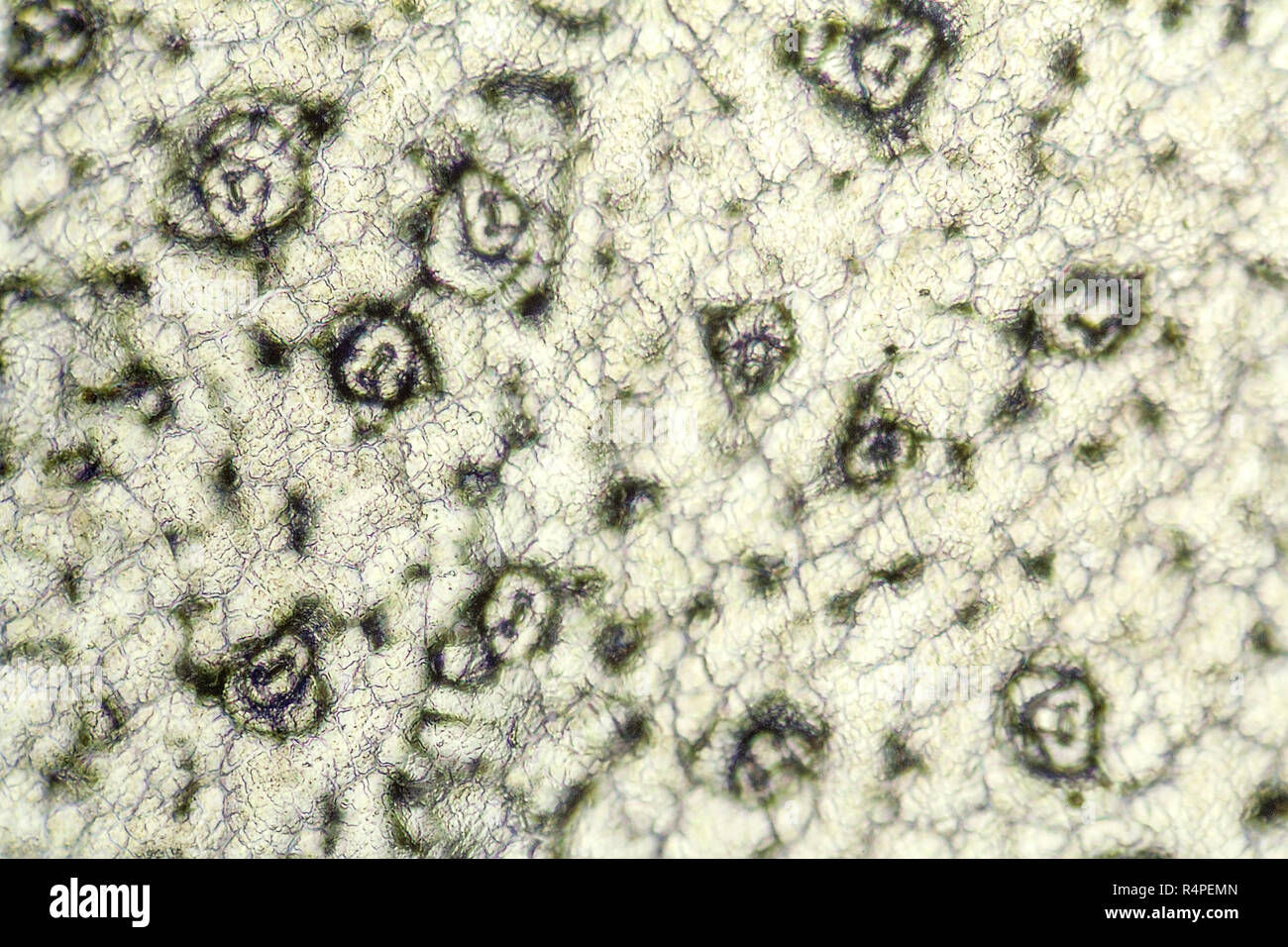 bryophyllum cell structure Stock Photo - Alamy
