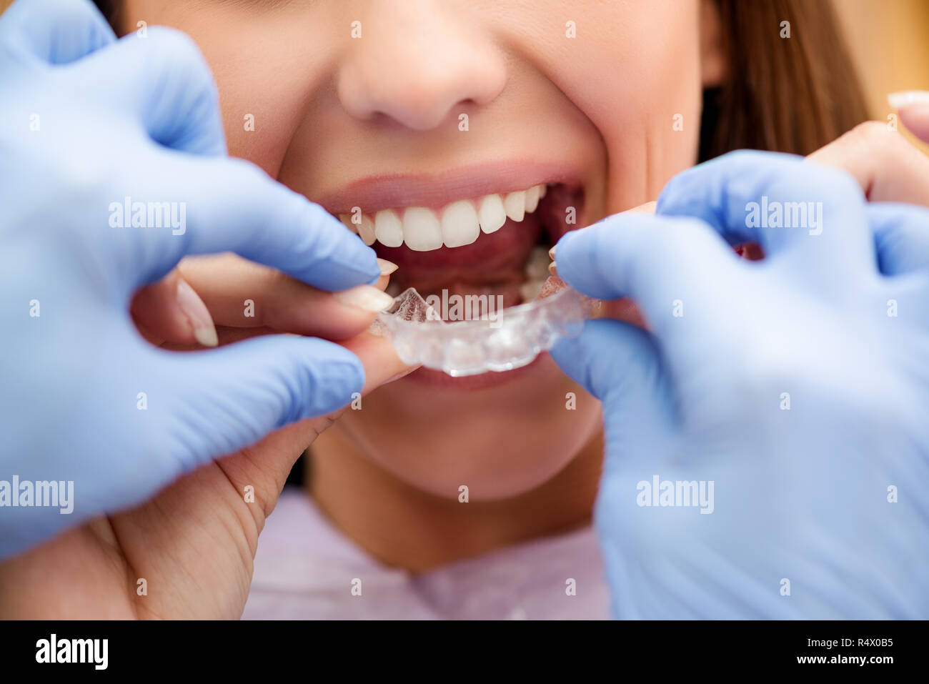 Orthodontic appliance hires stock photography and images Alamy