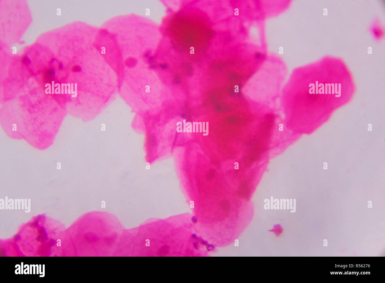 Multiple squamous epithelium under the microscope - Abstract pink dots on white background Stock Photo