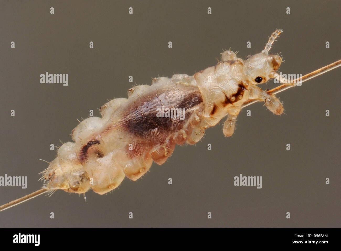 Head louse (Pediculus humanus capitis) on a human hair, Germany Stock Photo