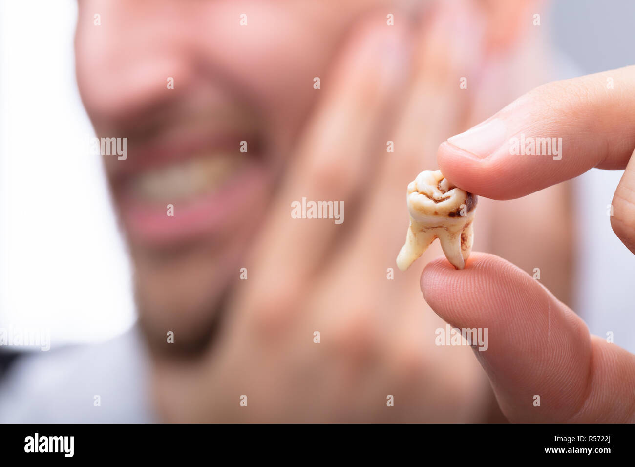 Close-up Of A Man's Hand Holding Decayed Tooth Stock Photo