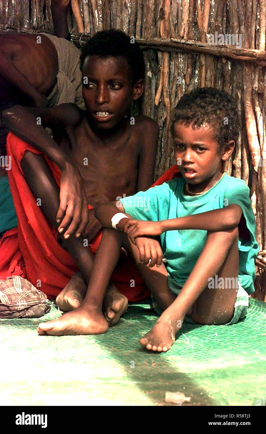 1992 - Straight on, Close-up shot of two Somali children sitting on a green mat in the bamboo hut.  The children are very emaciated looking. Stock Photo
