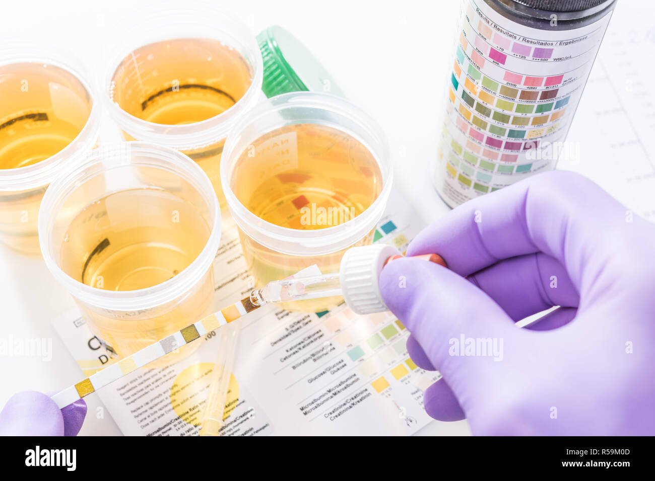 Test tires in violet gloves with test chart and urine can Stock Photo